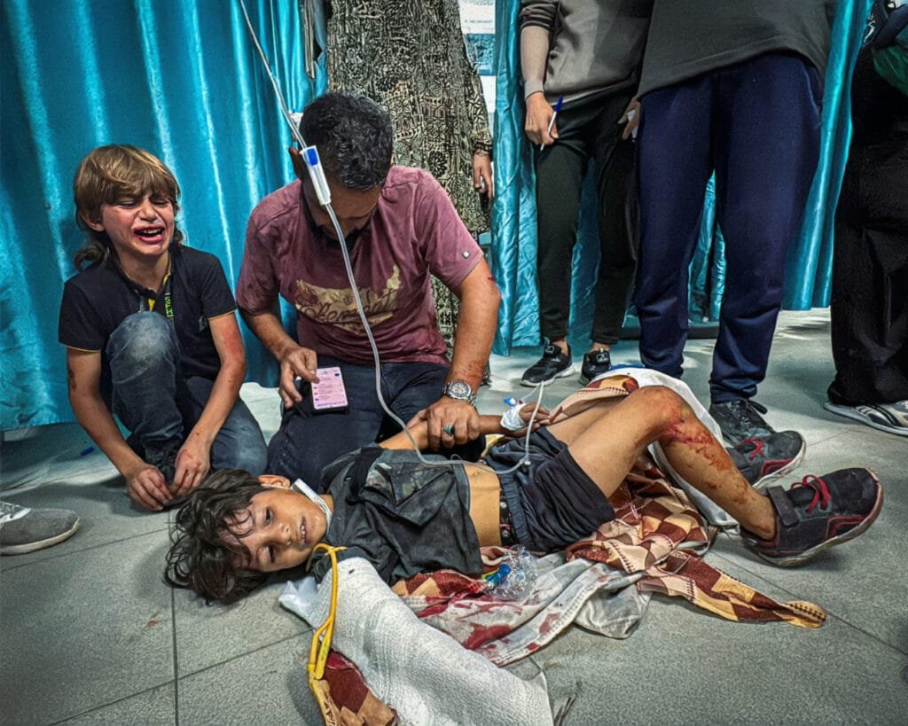 Gewonde kinderen worden behandeld in het Kamal Adwan-ziekenhuis in Jabalia, Gaza.